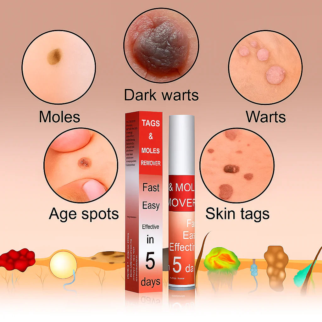 LOVILDS⢠Tags & Moles Remover (Buy 1 Get 1 Free)